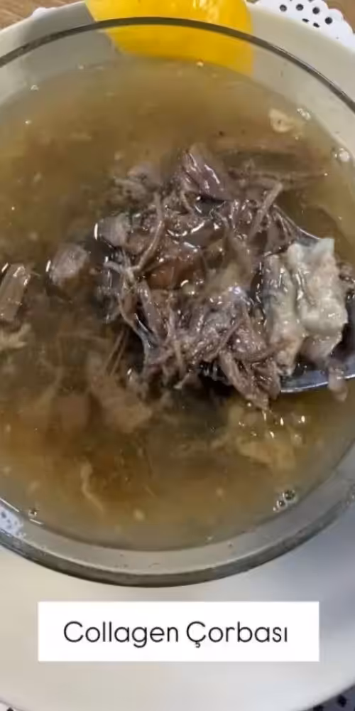 Seyma Subasi collagen corbasi