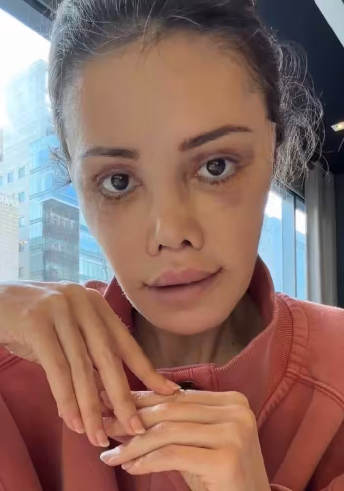 Survivor Didem Ceran